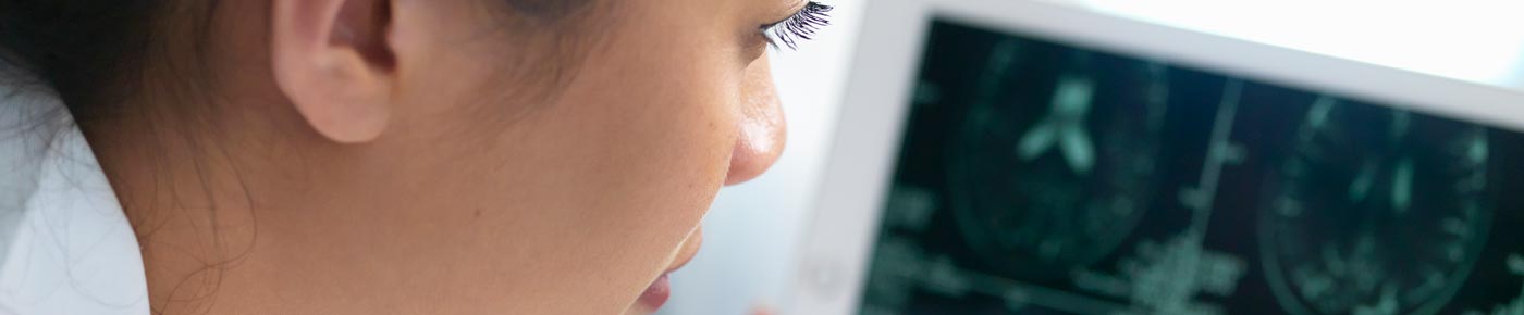 AI-VIDDA: los hongos de Hifas da Terra y la IA se alían en un ensayo clínico pionero en alzhéimer precoz